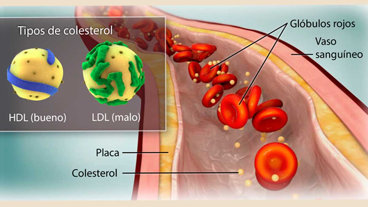 colesterol