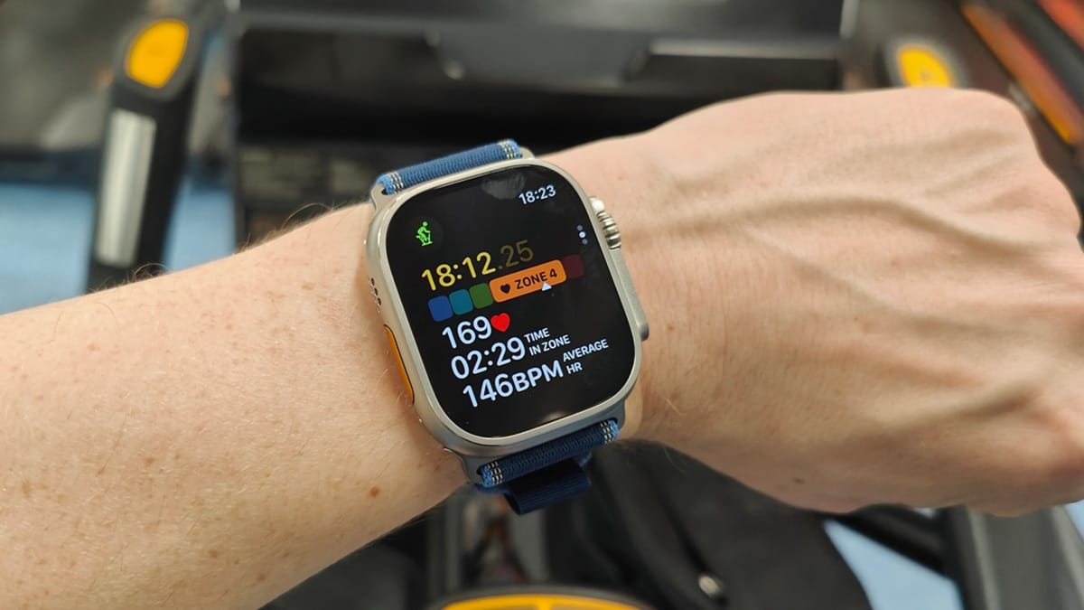smartwatch