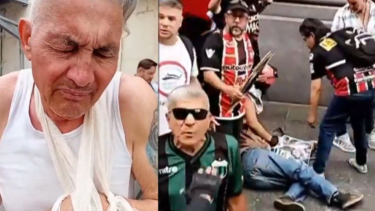 Habló el jubilado al que la Policía de Patricia Bullrich le quebró un brazo: "Me tiraron como un misil"