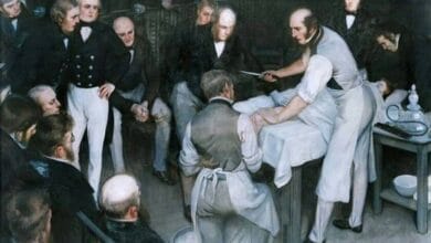 Ilustración de Robert Liston en el quirófano