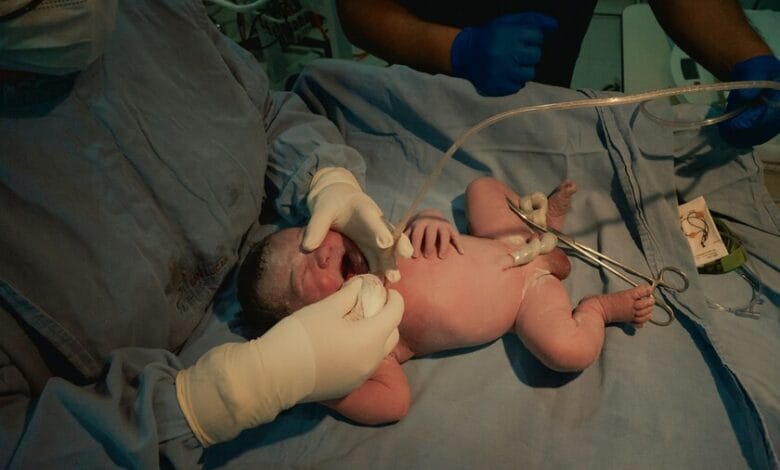 Imagen de un cordón umbilical