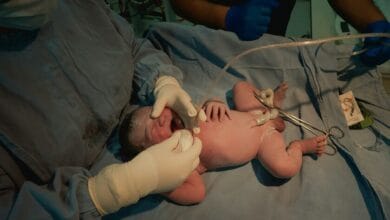 Imagen de un cordón umbilical