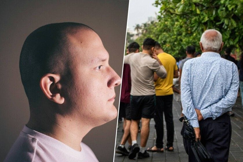 Imágenes de personas con calvicie y estrés