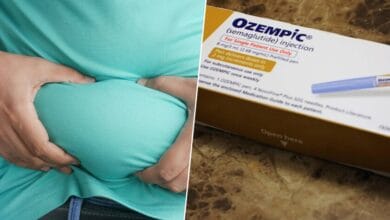 Persona con obesidad mórbida