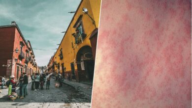 Gráfico con la evolución de los casos de sarampión en México