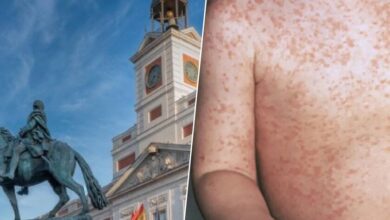 Imagen de un médico con mascarilla y guantes, examinando a un paciente con síntomas de sarampión