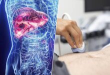 Imagen de una persona con una dieta saludable y ejercicio regular