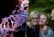 Imagen de una célula humana con el cromosoma extra 21 destacado