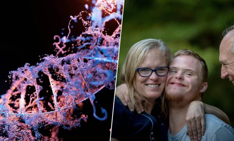 Imagen de una célula humana con el cromosoma extra 21 destacado