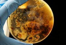 Imagen de un hongo bajo el microscopio