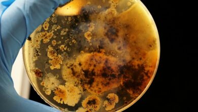 Imagen de un hongo bajo el microscopio