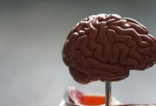 Ilustración del cerebro humano con áreas afectadas por el Alzhéimer