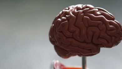 Ilustración del cerebro humano con áreas afectadas por el Alzhéimer