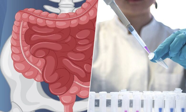 Imagen de un médico explicando sobre el cáncer de colon