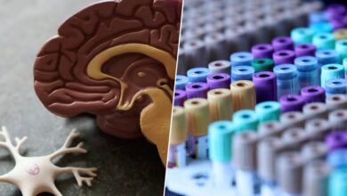 Imagen de un cerebro humano con una zona afectada por el alzhéimer