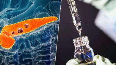 Ilustración del cáncer de páncreas y la terapia dirigida daraxonrasib