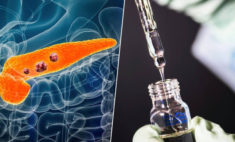 Imagen de un paciente con cáncer de páncreas