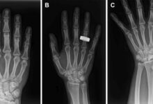 Astronautas tomando radiografías en órbita