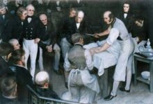 Imagen de Robert Liston en el quirófano