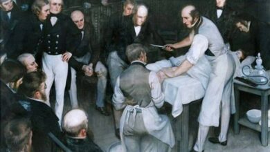 Imagen de Robert Liston en el quirófano