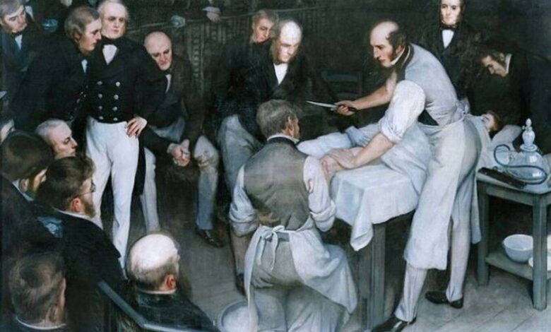 Robert Liston, cirujano más rápido de la historia