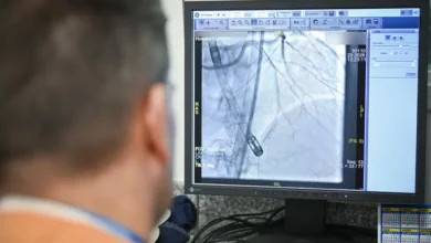 Equipo médico realizando una angioplastia coronaria con soporte mecánico en el Hospital Córdoba