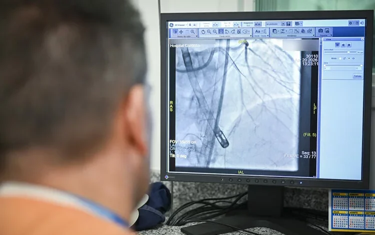 Equipo médico realizando una angioplastia coronaria con soporte mecánico en el Hospital Córdoba