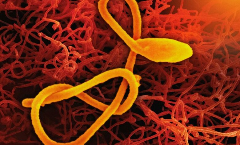 Imagen representativa del virus ébola Bundibugyo en África