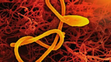 Muestra del virus ébola Bundibugyo bajo microscopio