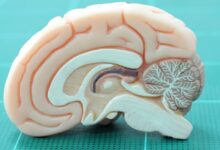 Imagen de resonancia magnética que muestra el hipocampo y áreas de recompensa cerebral