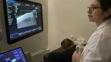 Transductor de alta frecuencia de 15 MHz instalado en el ecógrafo Mindray DC-70 del Hospital San Roque