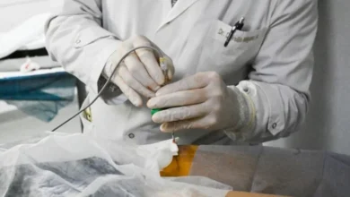 Equipo médico realizando ablación por radiofrecuencia en el Hospital Tránsito Cáceres de Allende